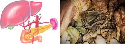A rare hepatic artery variant reporting and a new classification